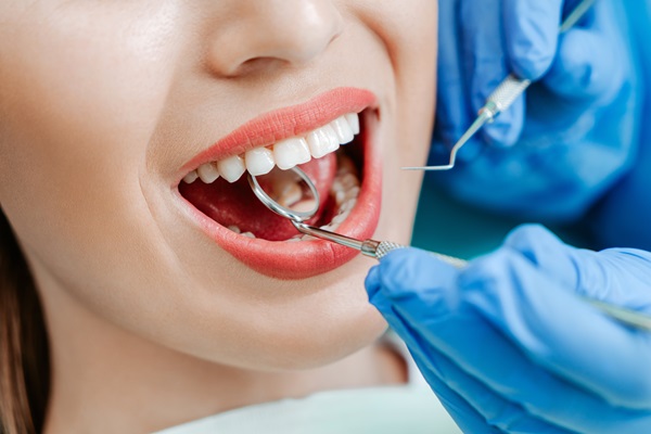 Issues A Cosmetic Dentist Can Fix With Dental Veneers