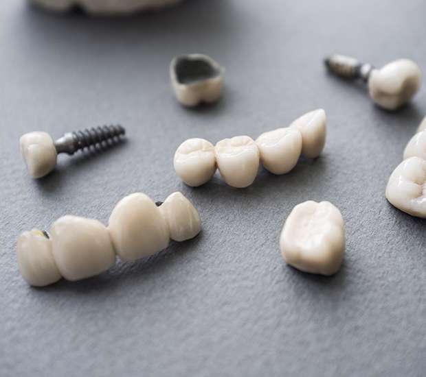 Difference Between Dental Implants Mini Dental Implants Dr